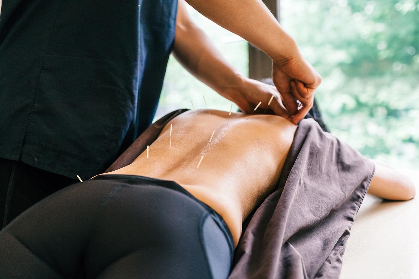 acupuncture-health-services-emkiro-downtown-toronto